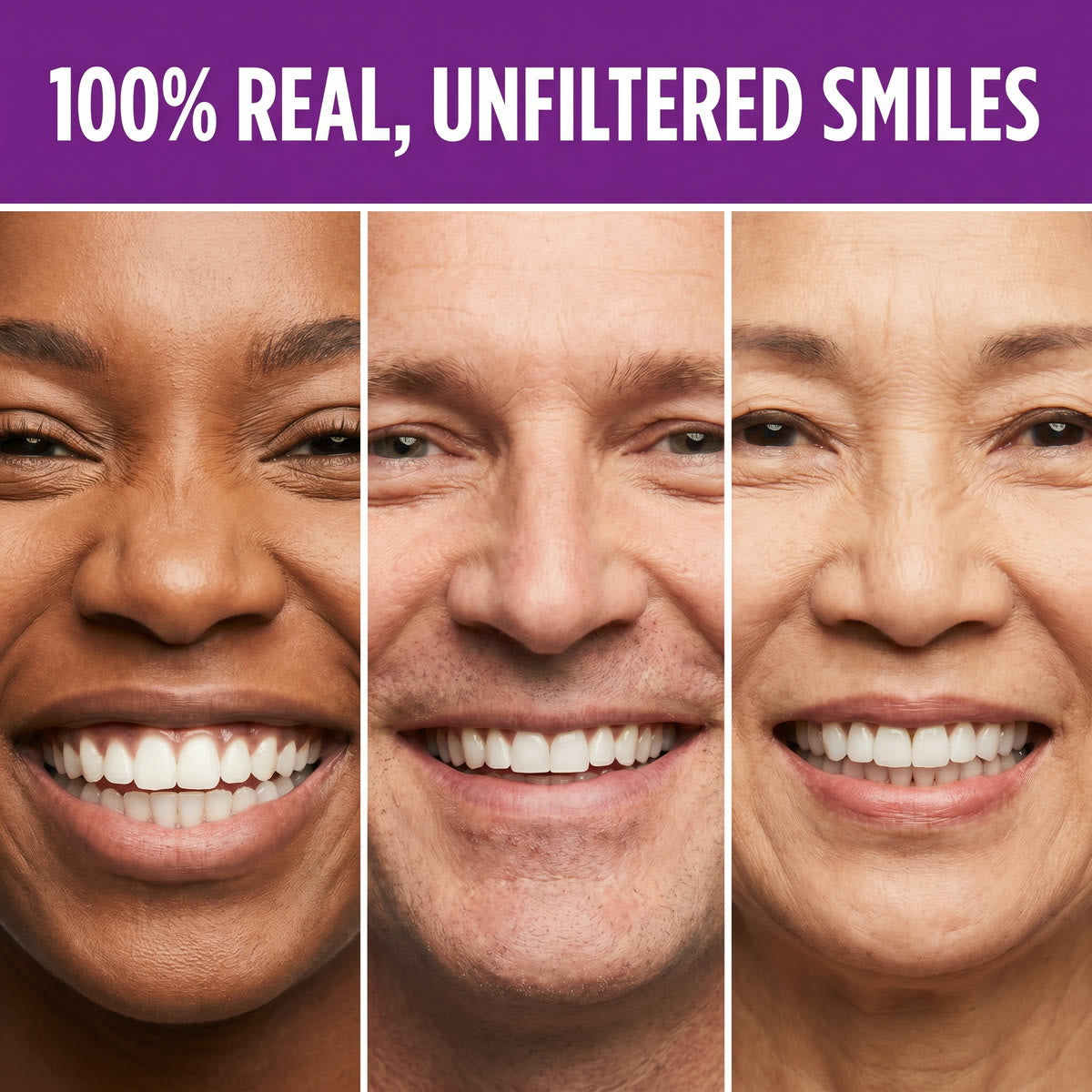 PurpleSnow Whitening Strips