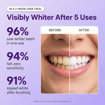 PurpleSnow Whitening Strips