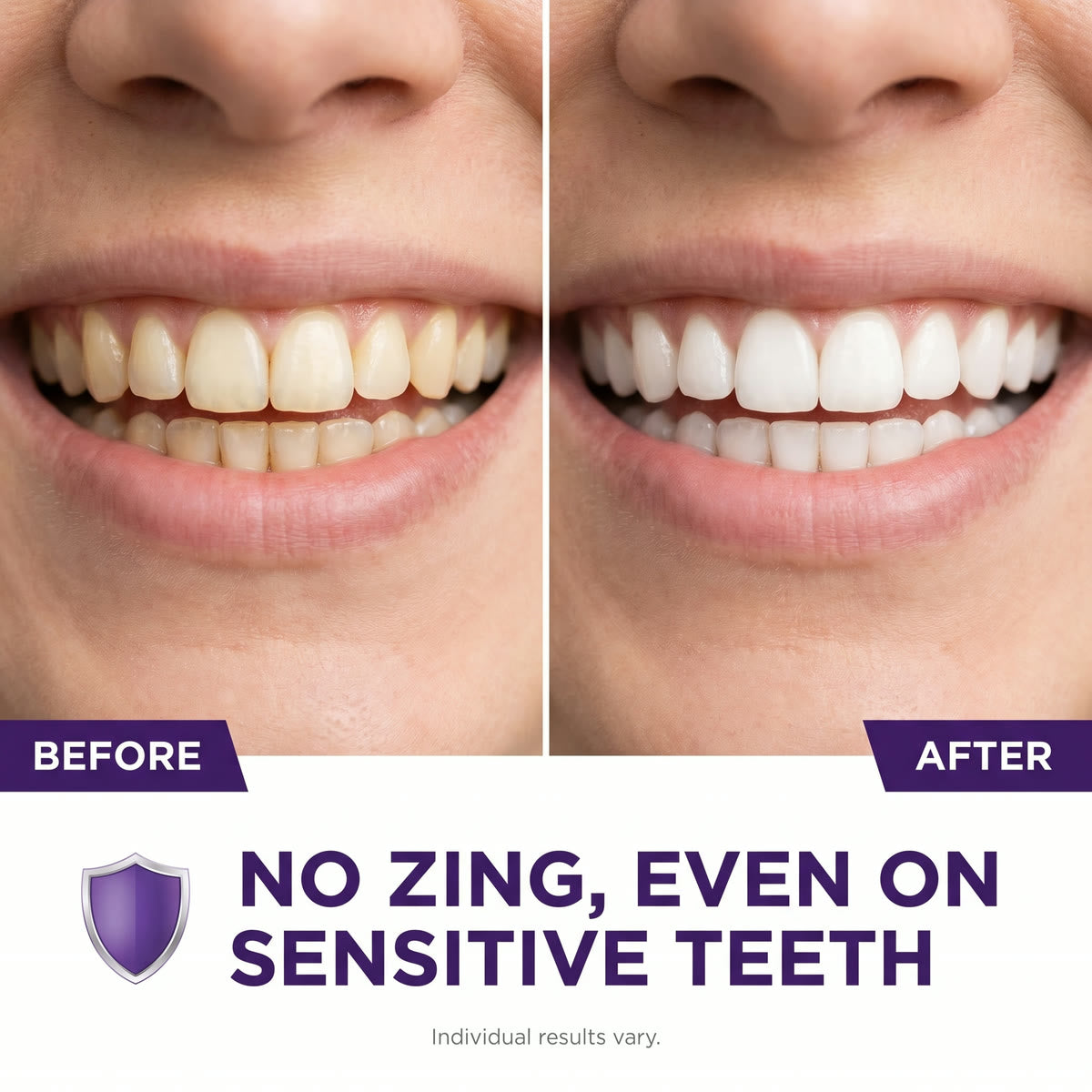 PurpleSnow Whitening Strips