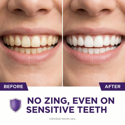 PurpleSnow Whitening Strips